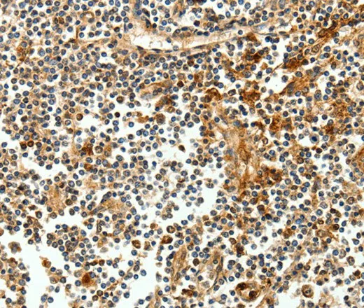 CEACAM21 Polyclonal Antibody - image 1