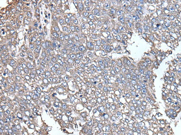 SCP2 Polyclonal Antibody - image 1