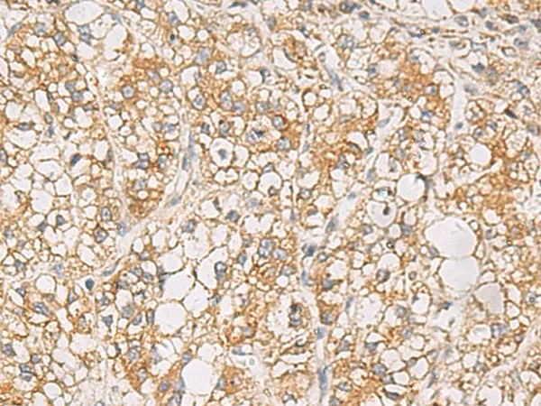 PTPRN Polyclonal Antibody - image 1
