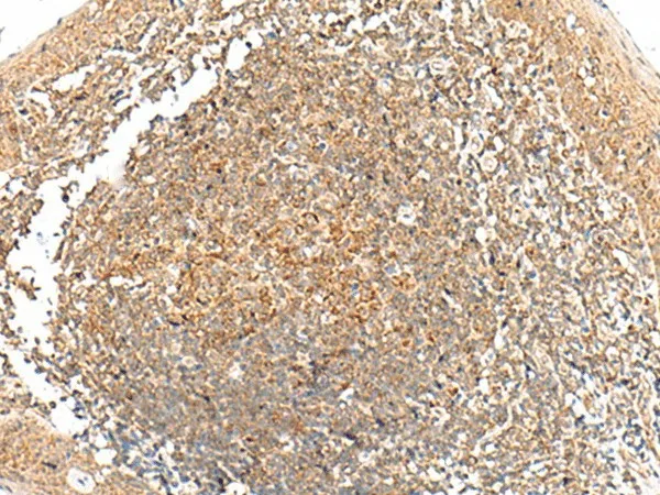 GRHPR Polyclonal Antibody - image 1
