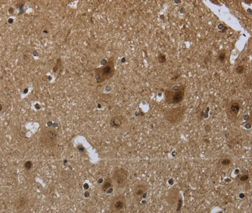 CD236 Polyclonal Antibody - image 1