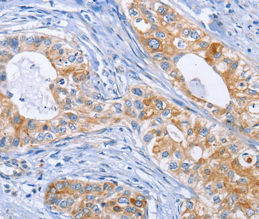DOK4 Polyclonal Antibody - image 1