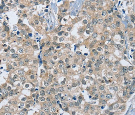 RAB8B Polyclonal Antibody - image 1