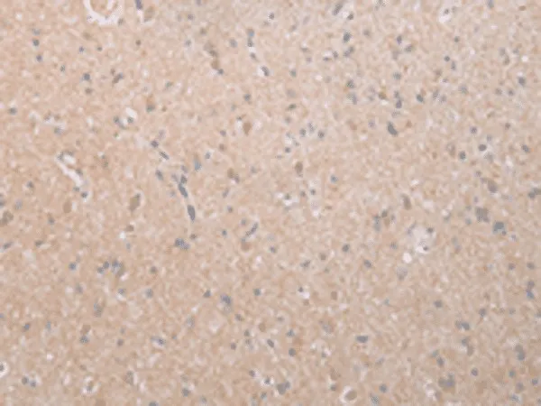 DEFB112 Polyclonal Antibody - image 1