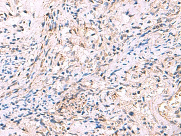 INPP5B Polyclonal Antibody - image 1