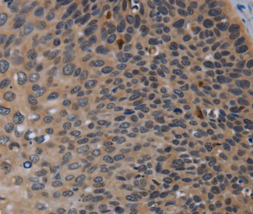 P2RX2 Polyclonal Antibody - image 2