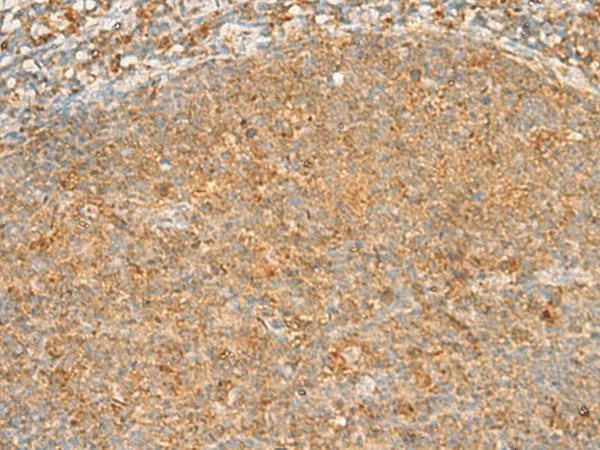 PPOX Polyclonal Antibody - image 1