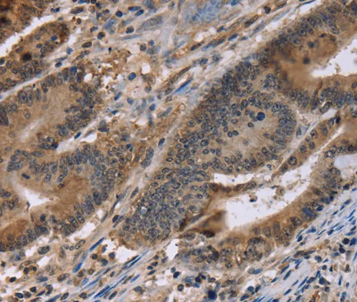 FAM107A Polyclonal Antibody - image 1