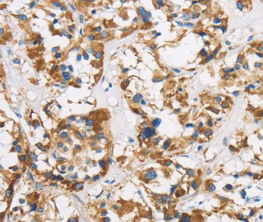 COX6B1 Polyclonal Antibody - image 1