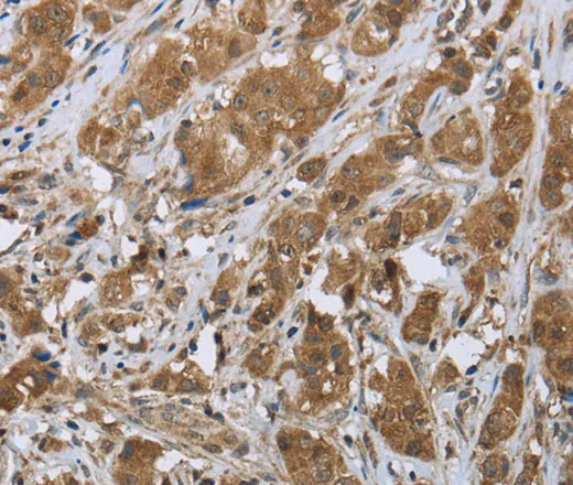 CLPS Polyclonal Antibody - image 1