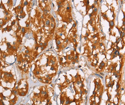 PLIN2 Polyclonal Antibody - image 1