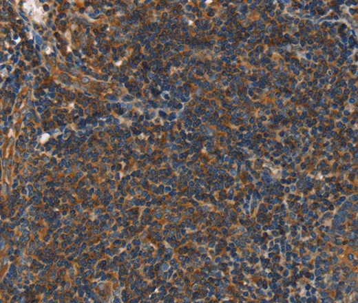 PLIN2 Polyclonal Antibody - image 2