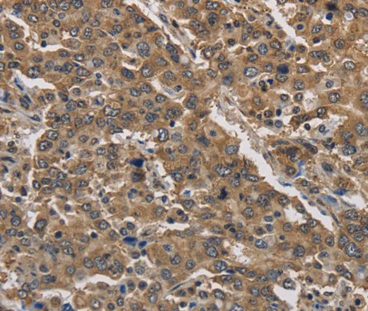 JAG2 Polyclonal Antibody - image 1