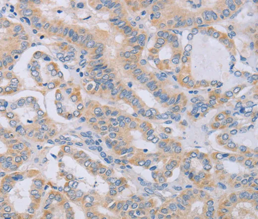 BGLAP Polyclonal Antibody - image 1