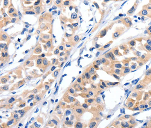 JAK2 Polyclonal Antibody - image 1