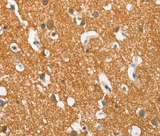 SNCA Polyclonal Antibody - image 1