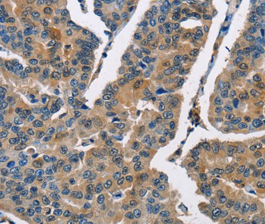 CBR1 Polyclonal Antibody - image 1