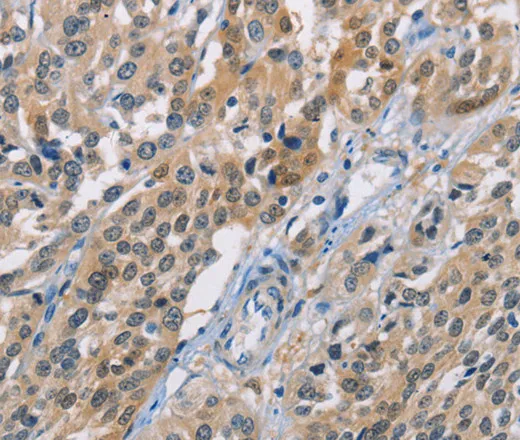 CBR1 Polyclonal Antibody - image 2
