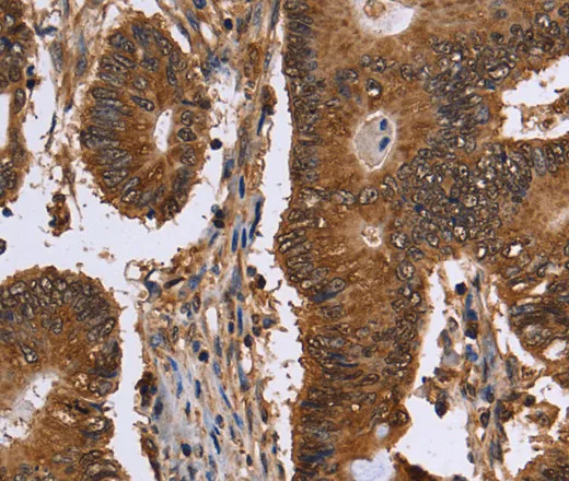 FANCF Polyclonal Antibody - image 1