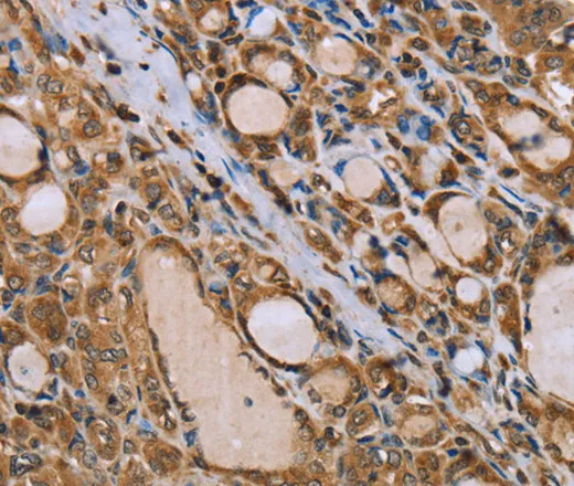 IKBKE Polyclonal Antibody - image 1