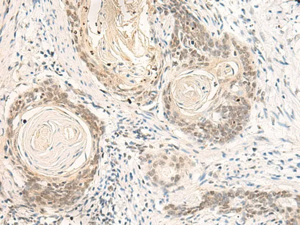 DPPA4 Polyclonal Antibody - image 1
