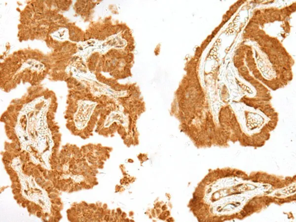 GANC Polyclonal Antibody - image 1