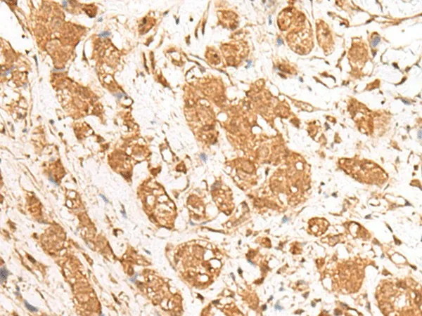 GANC Polyclonal Antibody - image 2