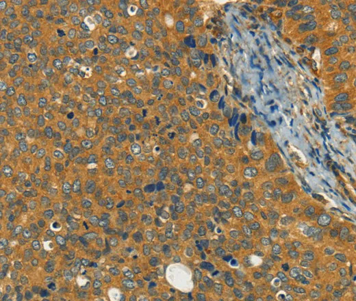 KLC1 Polyclonal Antibody - image 1