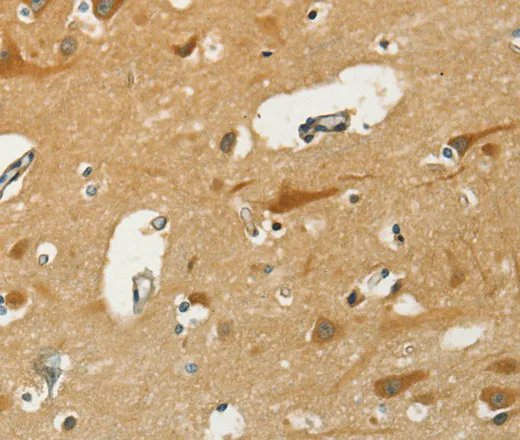 KLC1 Polyclonal Antibody - image 2