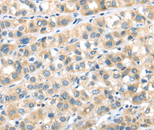 RIPK4 Polyclonal Antibody - image 1