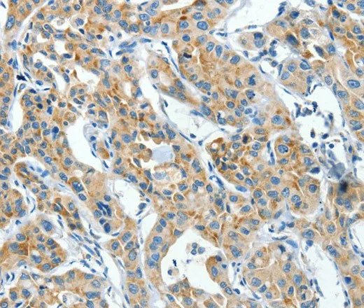 CKAP4 Polyclonal Antibody - image 1