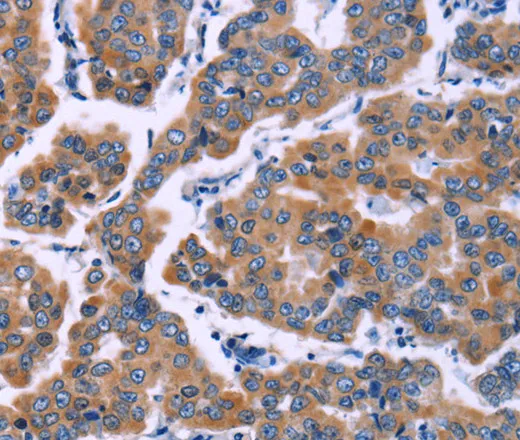 ZEB2 Polyclonal Antibody - image 1
