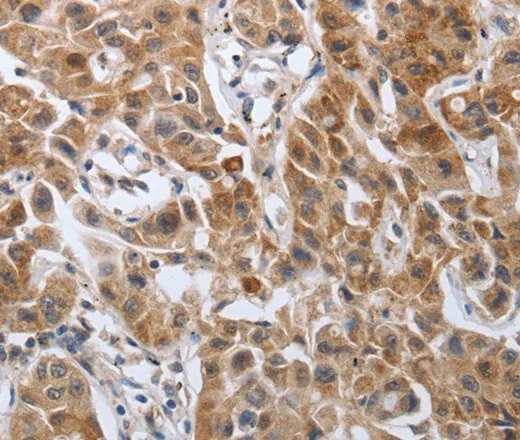 PDGFA Polyclonal Antibody - image 1