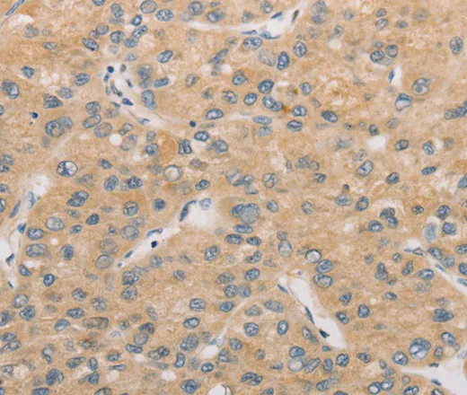 ATG4D Polyclonal Antibody - image 1