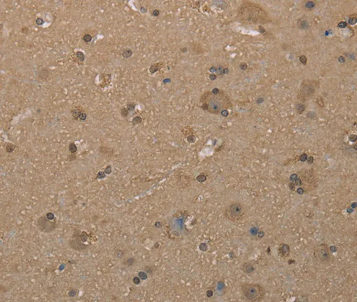 CAB39 Polyclonal Antibody - image 1