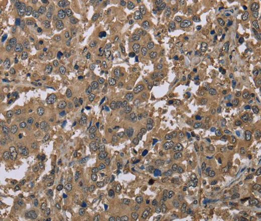 CAB39 Polyclonal Antibody - image 2