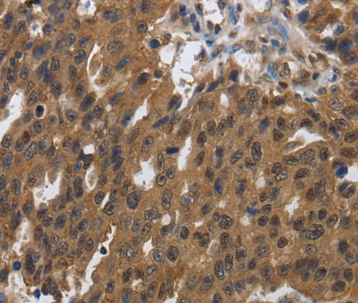 PDCD7 Polyclonal Antibody - image 1