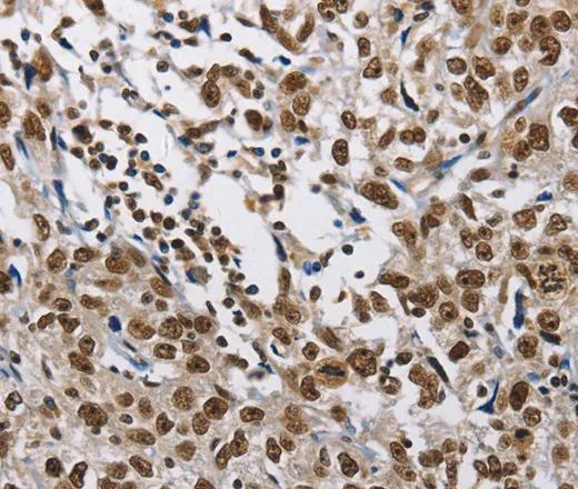 CMTM2 Polyclonal Antibody - image 1
