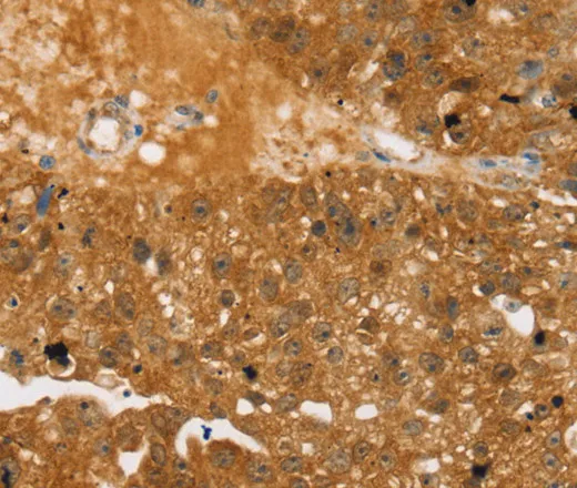 TBC1D4 Polyclonal Antibody - image 1