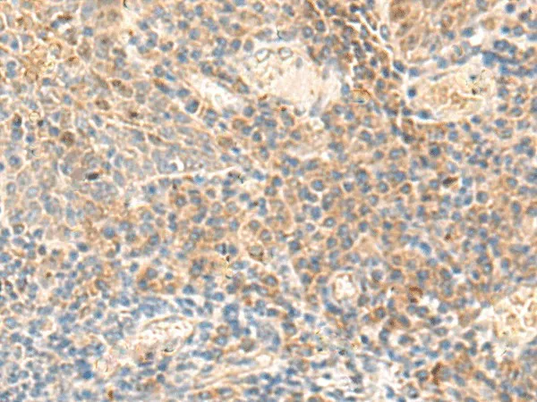 ABHD2 Polyclonal Antibody - image 1