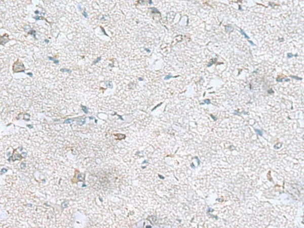 GFRA1 Polyclonal Antibody - image 1