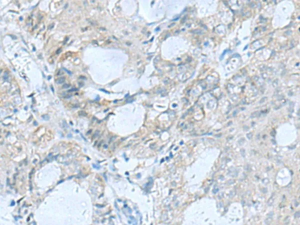 GFRA1 Polyclonal Antibody - image 2