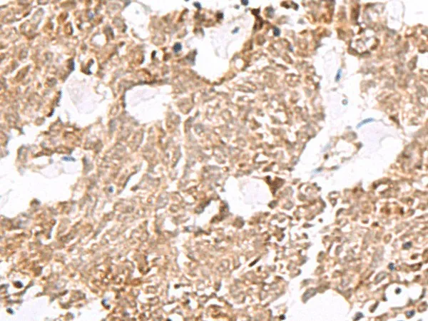 ELF3 Polyclonal Antibody - image 1
