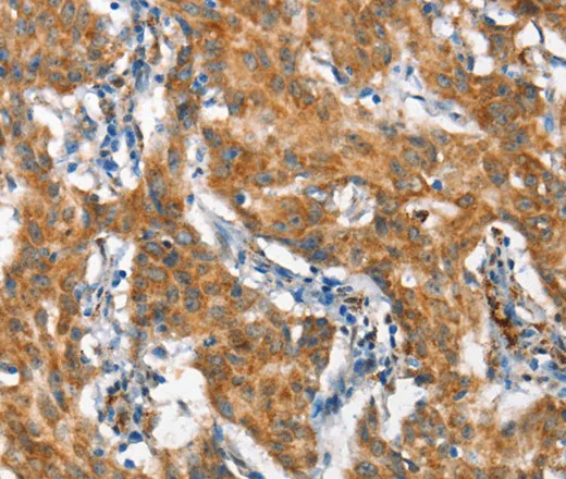 STAT2 Polyclonal Antibody - image 1