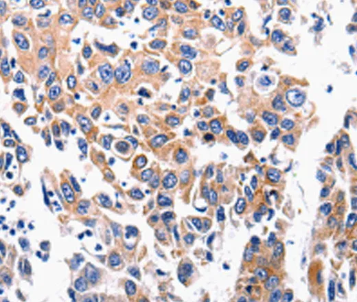 ACE2 Polyclonal Antibody - image 1