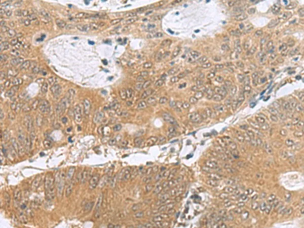 PHPT1 Polyclonal Antibody - image 1