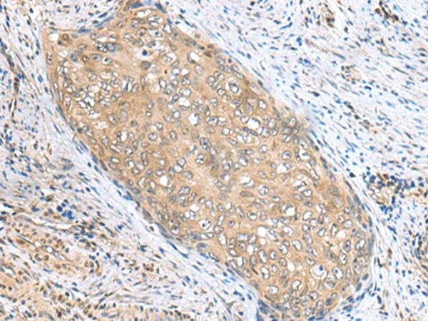 PHPT1 Polyclonal Antibody - image 2