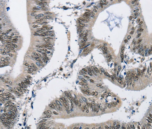 CMTM2 Polyclonal Antibody - image 1
