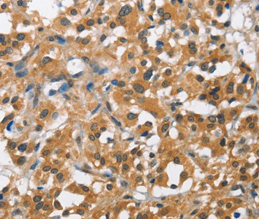 BCL10 Polyclonal Antibody - image 1