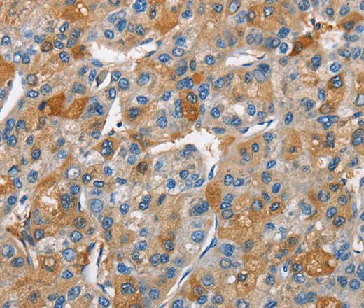 BCL10 Polyclonal Antibody - image 2